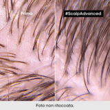 L'Oreal Professionnel Paris Scalp Advanced Anti-Oiliness Shampoo 500ml - champú seborregulador