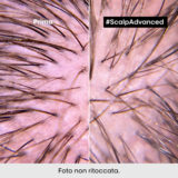 L'Oreal Professionnel Paris Scalp Advanced Anti-Discomfort Shampoo 500ml  - champú calmante